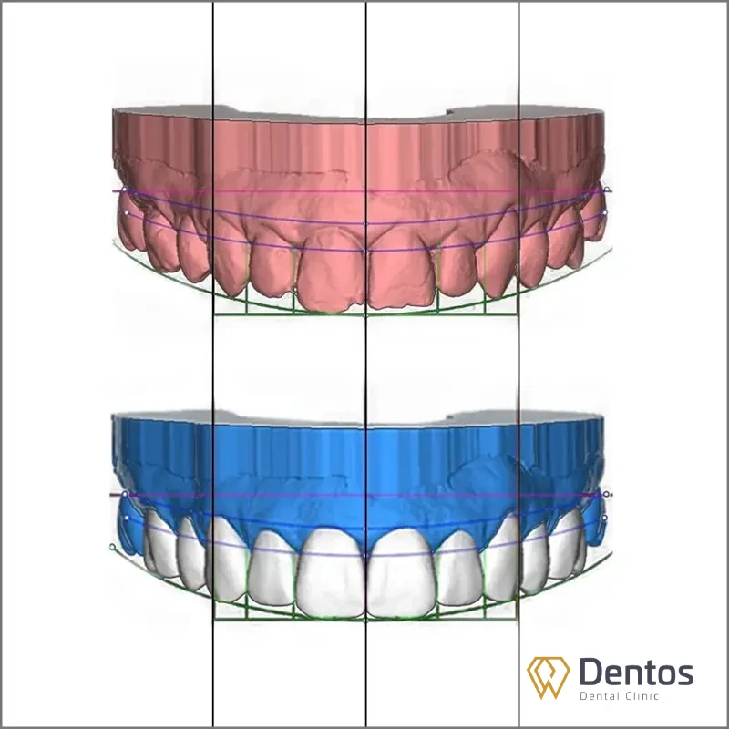 Công nghệ DSD thiết kế nụ cười phù hợp từng người